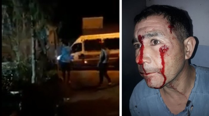Policía de Chubut dispara contra personas que no hacen la cuarentena en  villas