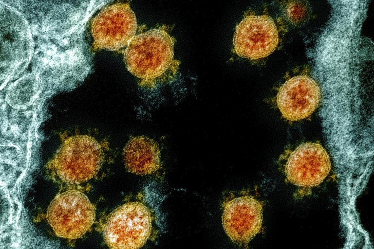 De asintomático a enfermo grave: el escalofriante misterio del COVID-19 que se esconde en el sistema inmunológico