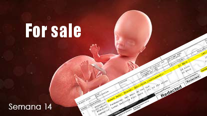 Planned Parenthood admitió la venta de fetos abortados y prometió que en el futuro no cobrará por ellos en el mercado norteamericano