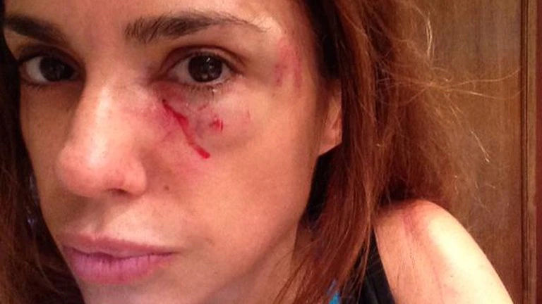 Una periodista denunció que la agredieron en la vía pública